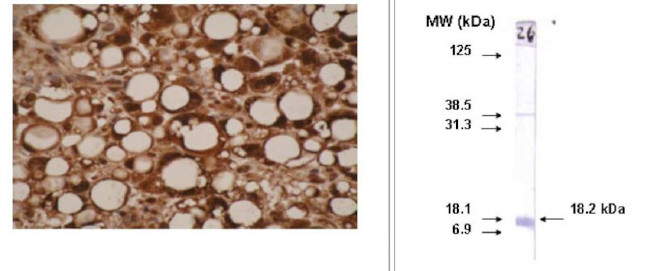 CYP26A1 Antibody in Immunohistochemistry (IHC)