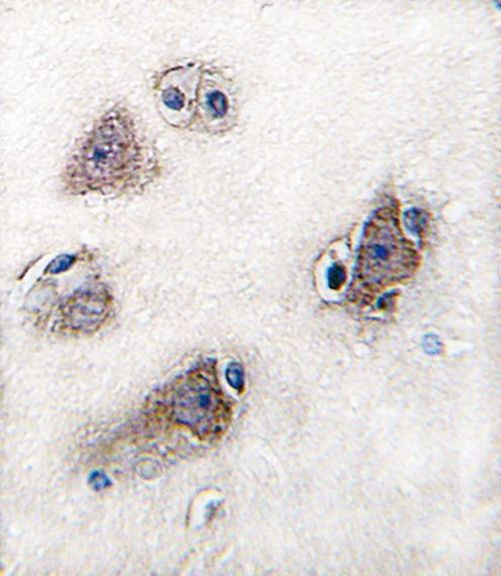 CYP26C1 Antibody in Immunohistochemistry (IHC)