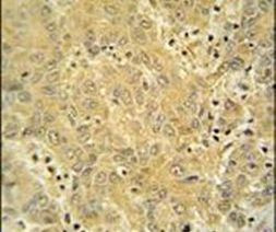 CYP2A7 Antibody in Immunohistochemistry (IHC)