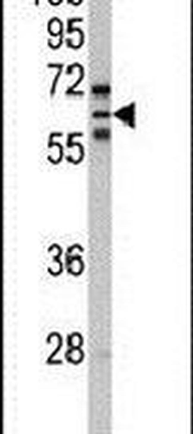 CYP2C8 Antibody in Western Blot (WB)
