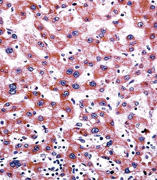 CYP2C9 Antibody in Immunohistochemistry (IHC)