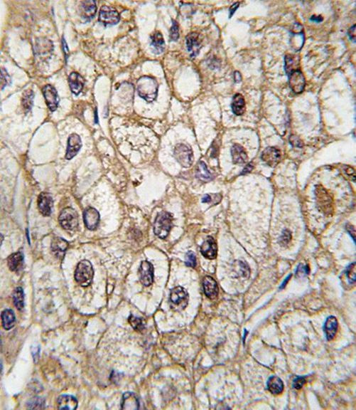 CYP2C9 Antibody in Immunohistochemistry (IHC)