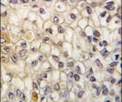 CYP2F1 Antibody in Immunohistochemistry (IHC)