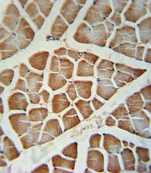 CYP2J2 Antibody in Immunohistochemistry (IHC)