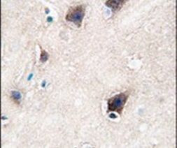 CYP2R1 Antibody in Immunohistochemistry (IHC)