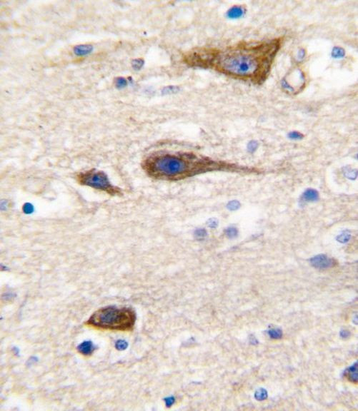 CYP2R1 Antibody in Immunohistochemistry (IHC)