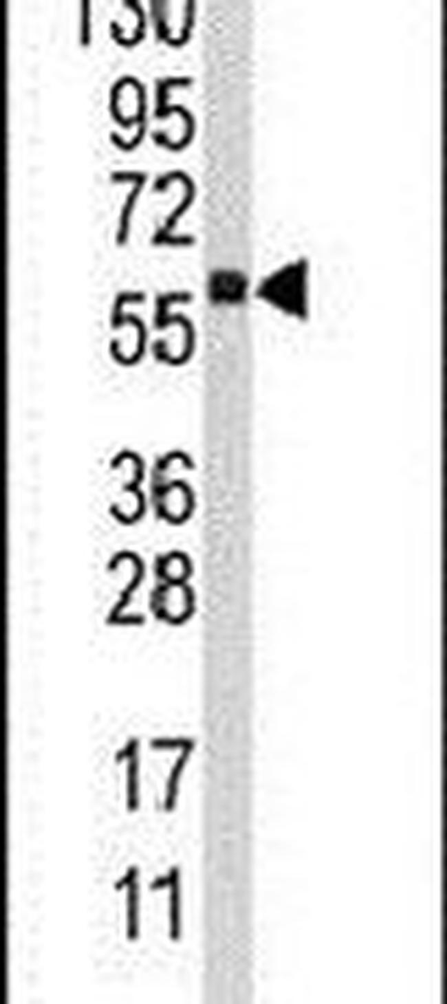 CYP4F12 Antibody in Western Blot (WB)