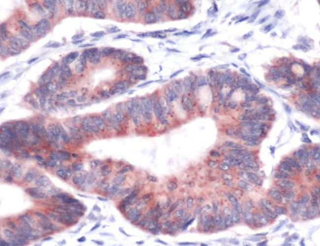 CYR61 Antibody in Immunohistochemistry (IHC)