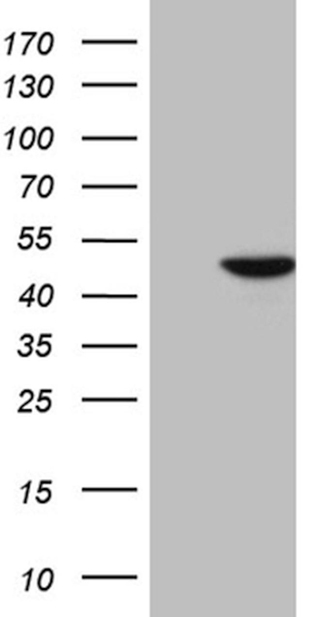 CYTH4 Antibody in Western Blot (WB)