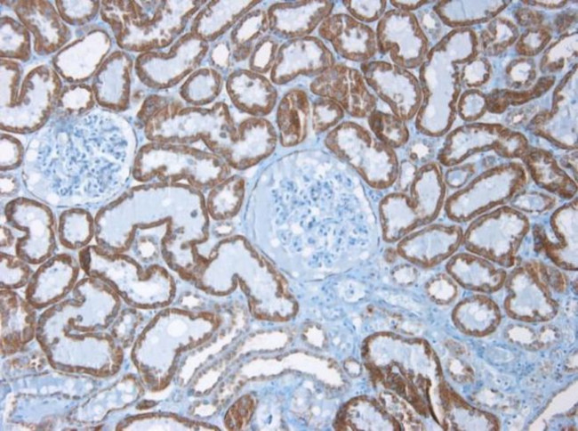 K-cadherin Antibody in Immunohistochemistry (Paraffin) (IHC (P))