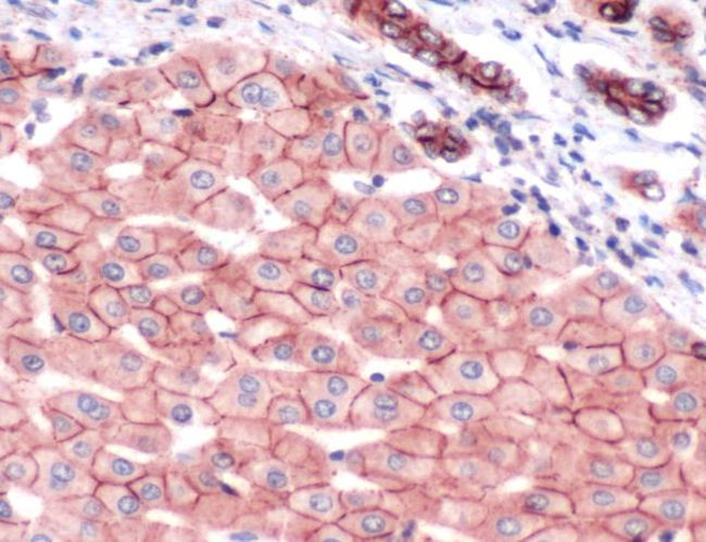 N-cadherin Antibody in Immunohistochemistry (IHC)