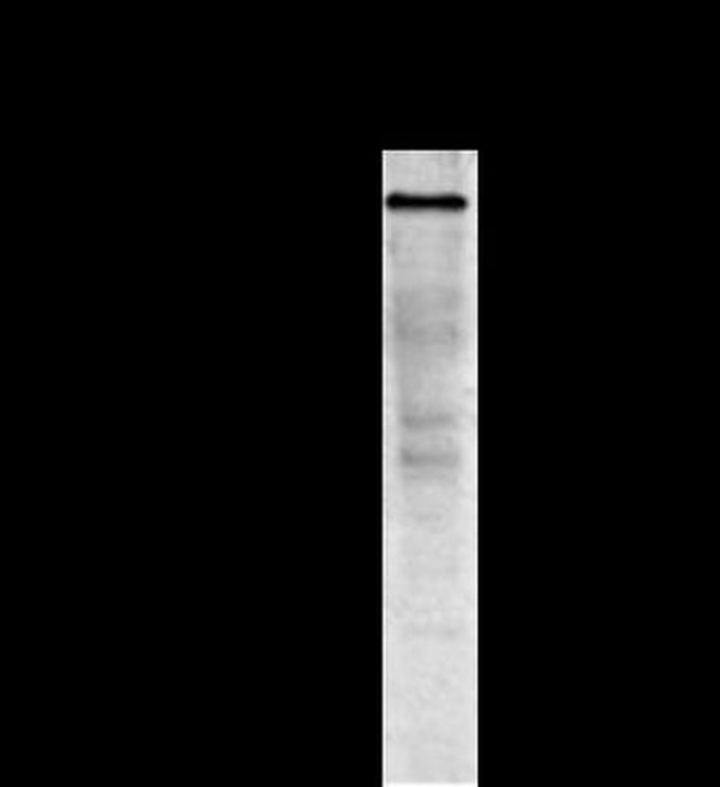 CDH11 Monoclonal Antibody (16A) (MA106306)