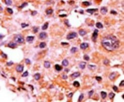 Calcineurin A Antibody in Immunohistochemistry (IHC)