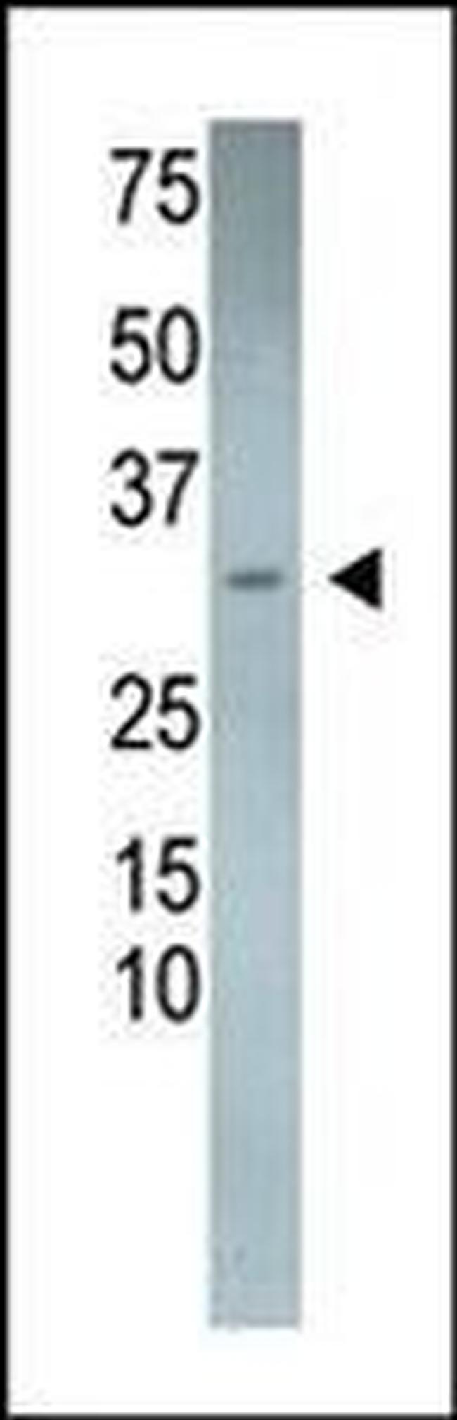 RCAN3 Antibody in Western Blot (WB)