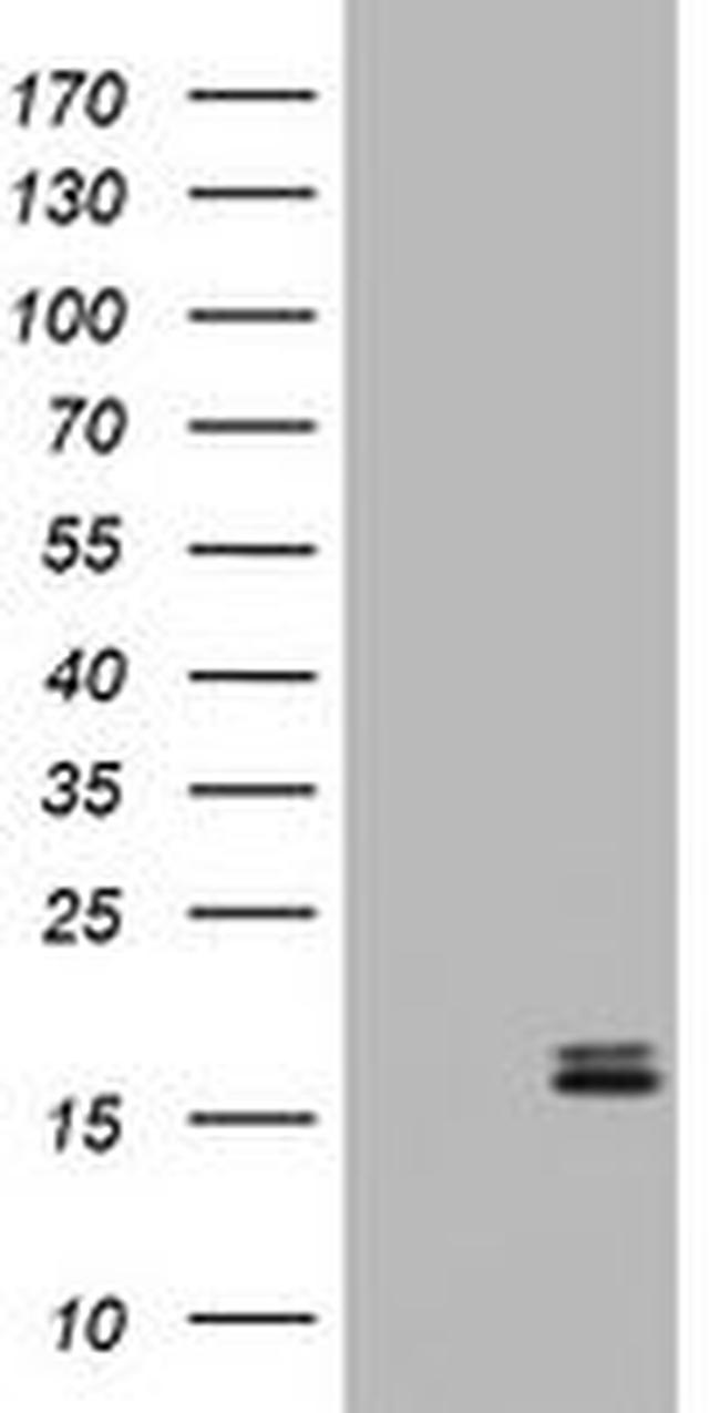 Calcitonin (CALCA) Antibody in Western Blot (WB)