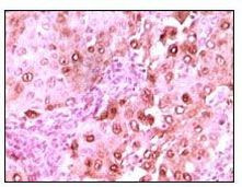 Calcyclin Antibody in Immunohistochemistry (Paraffin) (IHC (P))