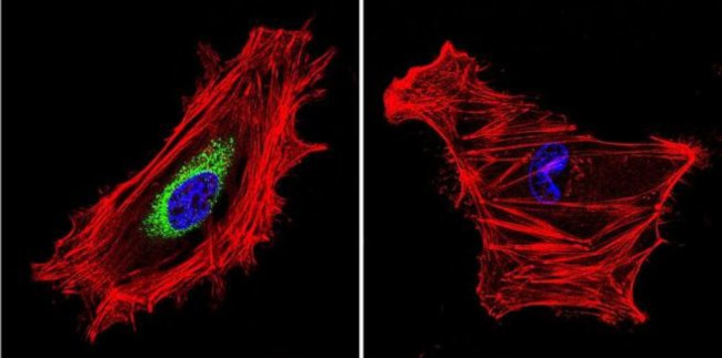 Calpain S1 Antibody in Immunocytochemistry (ICC/IF)