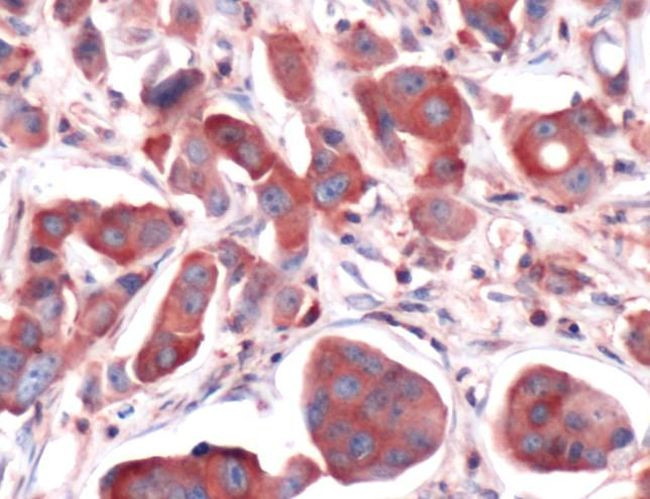 Calpain S1 Antibody in Immunohistochemistry (IHC)