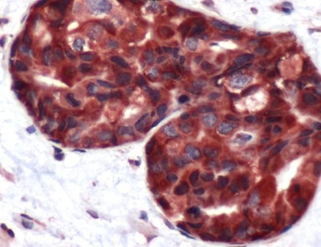Calpastatin Antibody in Immunohistochemistry (IHC)