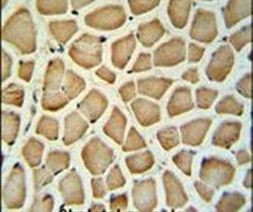 Calponin 3 Antibody in Immunohistochemistry (IHC)