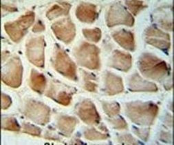 Calponin 3 Antibody in Immunohistochemistry (IHC)
