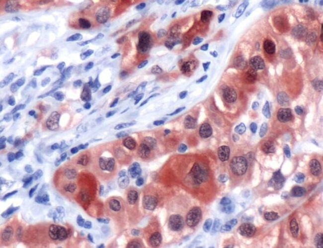 Calretinin Antibody in Immunohistochemistry (IHC)