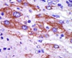CK1 delta Antibody in Immunohistochemistry (IHC)