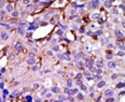 CASK Antibody in Immunohistochemistry (IHC)