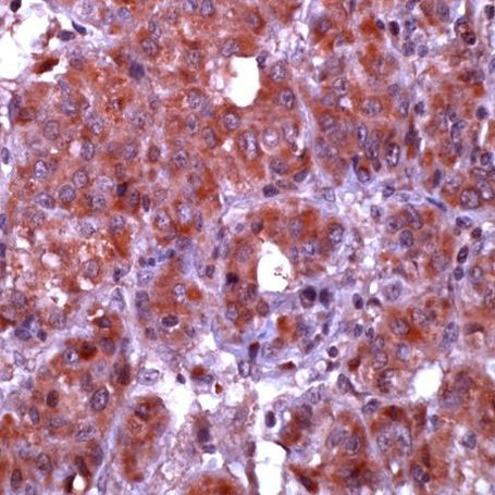 Caspase 10 Antibody in Immunohistochemistry (IHC)