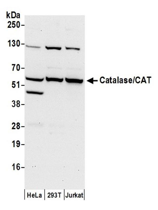 Catalase/CAT Antibody in Western Blot (WB)