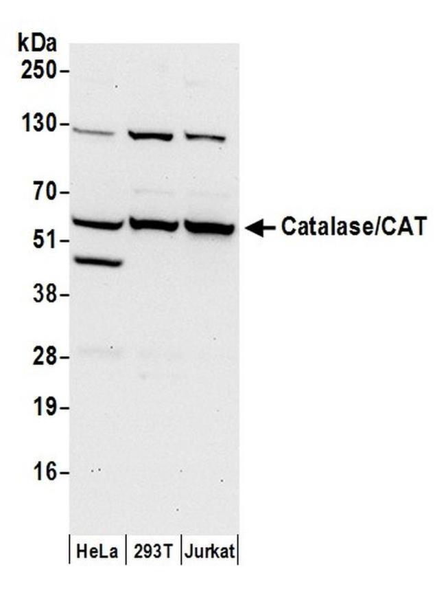 : catalase 60,000 - unique potency and full... Catalase/CAT Polyclonal Antibody (A304-767A-T)
