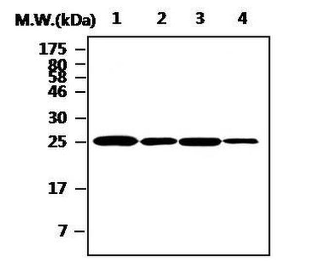 Cathepsin H Antibody in Western Blot (WB)
