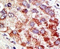 c-Cbl Antibody in Immunohistochemistry (IHC)