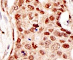 c-Cbl Antibody in Immunohistochemistry (IHC)