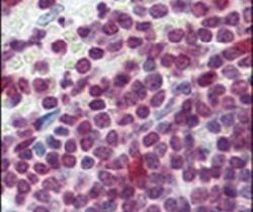 Cdc25A Antibody in Immunohistochemistry (IHC)