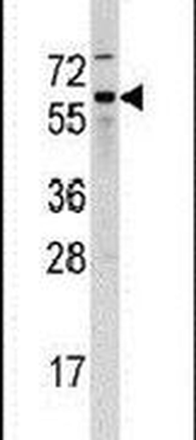 Cdc25B Antibody in Western Blot (WB)