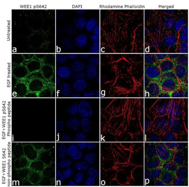 Phospho-WEE1 (Ser642) Antibody in Immunocytochemistry (ICC/IF)