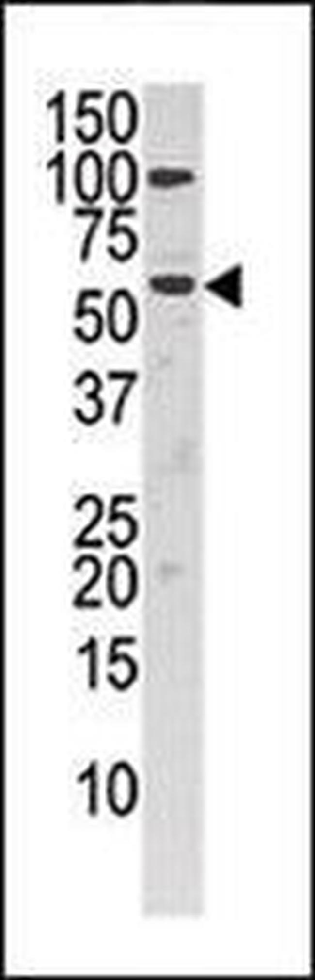 CHKA Antibody in Western Blot (WB)