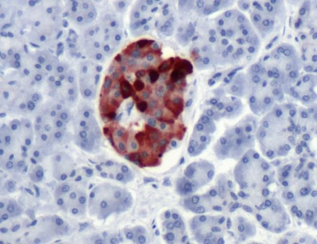 Chromogranin A Antibody in Immunohistochemistry (IHC)