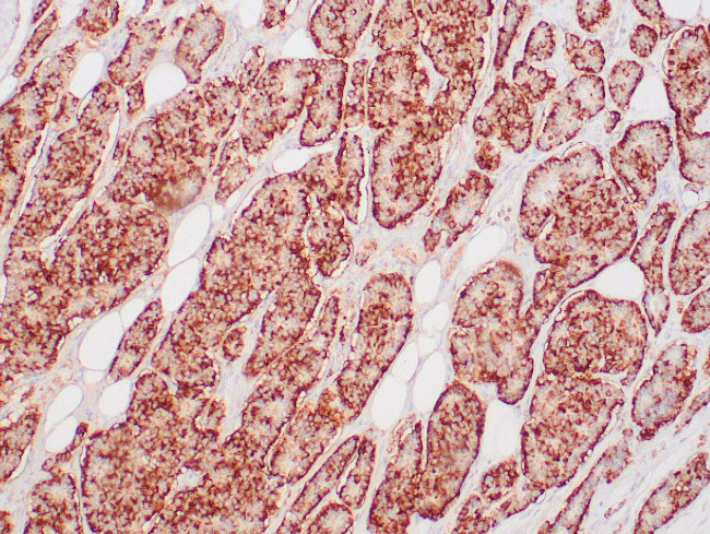 Chromogranin A Antibody in Immunohistochemistry (Paraffin) (IHC (P))