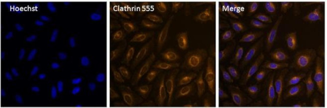 Clathrin Heavy Chain Antibody in Immunocytochemistry (ICC/IF)
