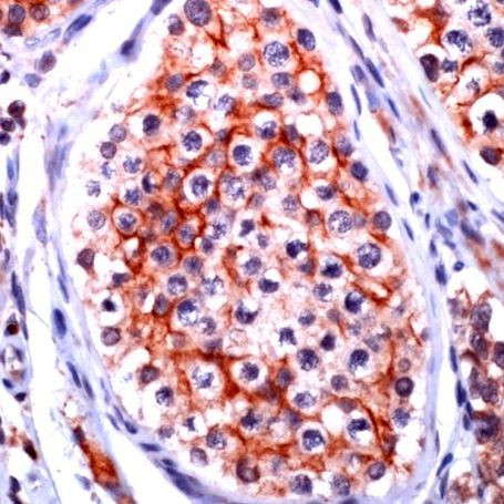 Claudin 11 Antibody in Immunohistochemistry (IHC)