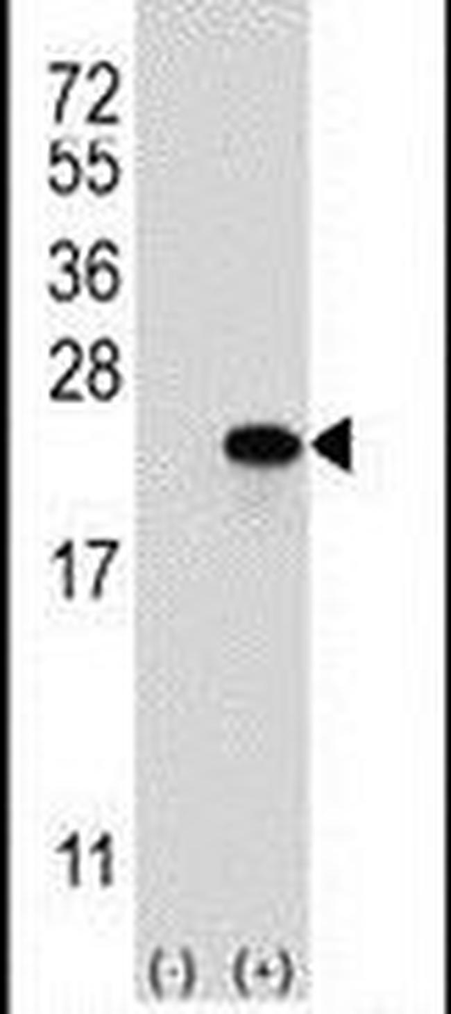 Claudin 1 Antibody in Western Blot (WB)