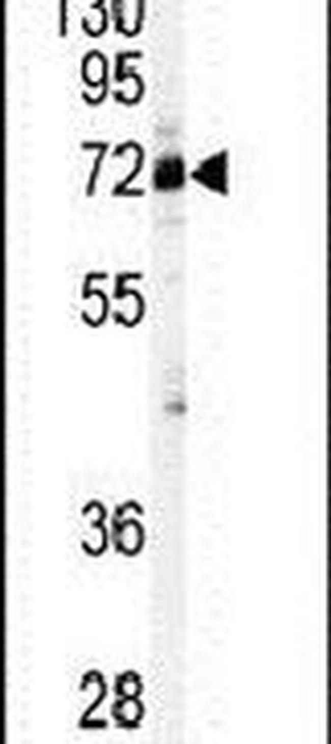 CSTF2 Antibody in Western Blot (WB)