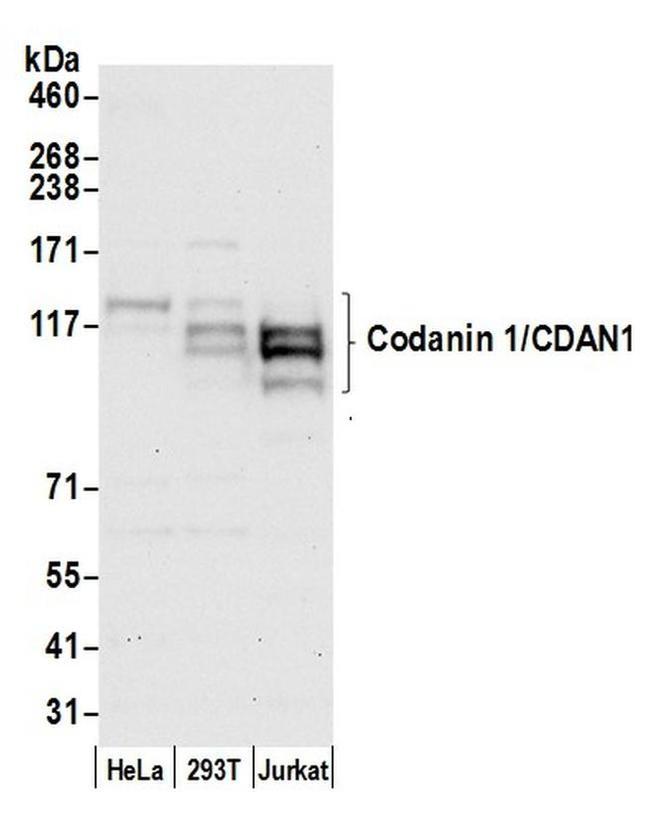 Codanin 1/CDAN1 Antibody in Western Blot (WB)