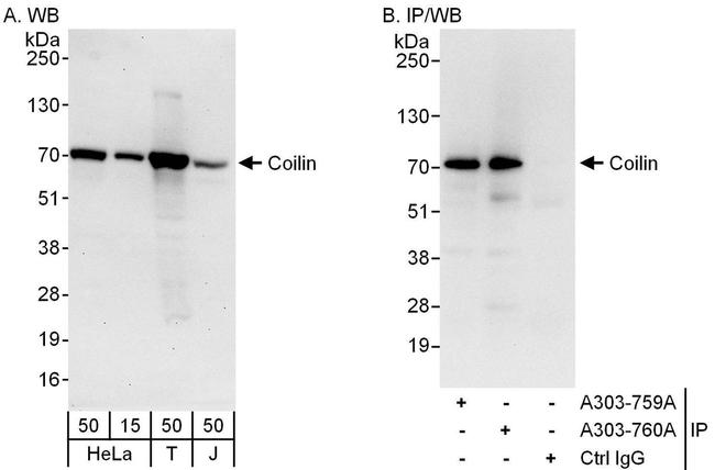 Coilin Antibody in Western Blot (WB)