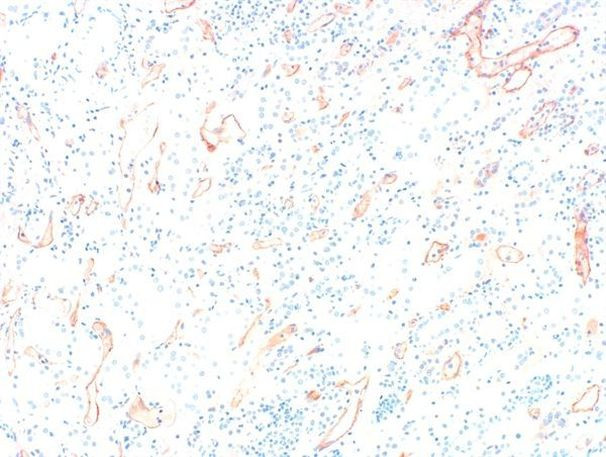 Complement C4d Antibody in Immunocytochemistry (ICC/IF)