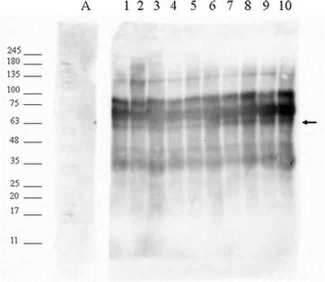 Complement C4b Antibody in Western Blot (WB)