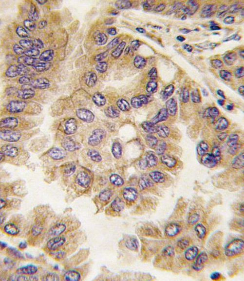 Connexin 40 Antibody in Immunohistochemistry (IHC)