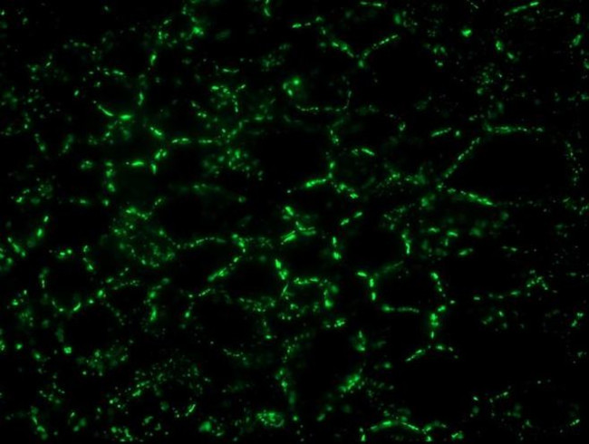 Connexin 26 Antibody in Immunohistochemistry (IHC)
